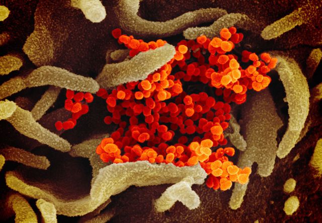 Image au microcospe du virus à l'origine du Covid-19. (illustration)