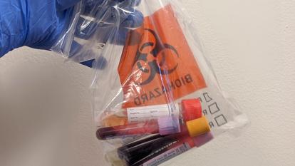 Selon une étude chinoise, notre groupe sanguin aurait une influence sur notre résistance face au coronavirus.