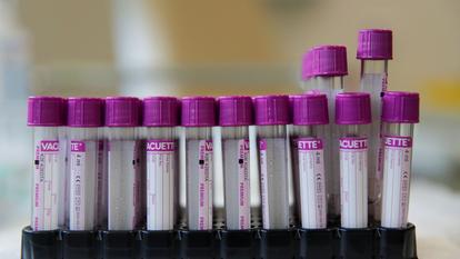 Suivons pas à pas le chemin de notre intrus, alias Sars-CoV-2, pour mieux comprendre comment la pharmacologie peut lui faire obstacle.