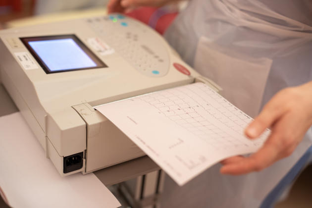 Hôpital Bichat, Paris, le 13 novembre. Un électrocardiogramme réalisé sur un patient de 48 ans atteint par le Covid-19.